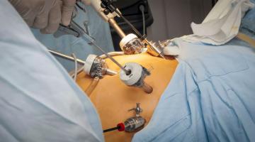 Endoscopische chirurgie
